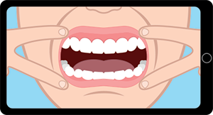 Smile-Assessment-Front