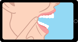 Smile-Assessment-Right